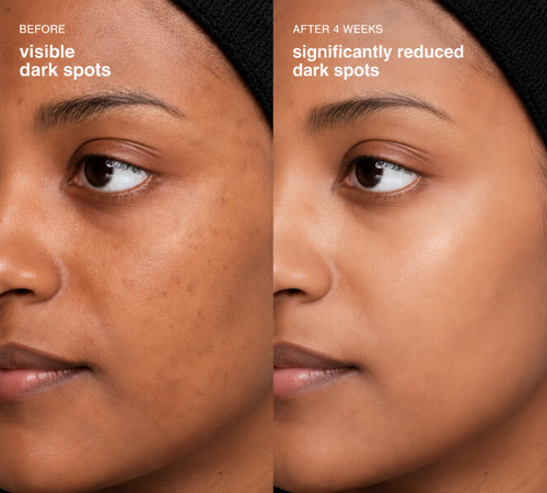 Seoul Dark Spot Glow Serum