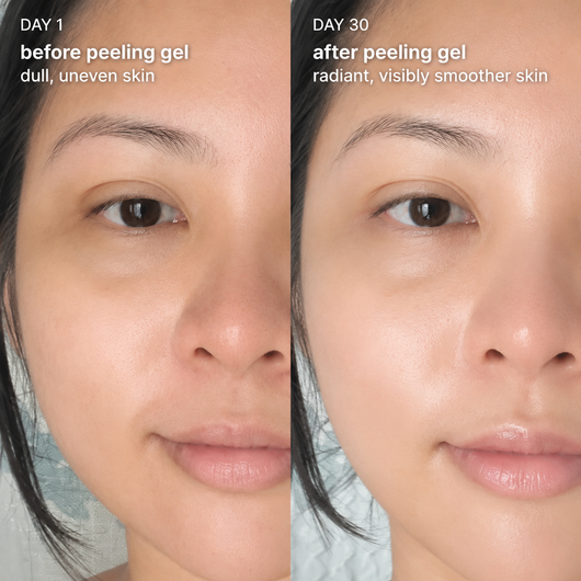 Sakura Dead Skin Peeling Gel